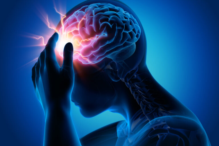 Migrena a terapia osteopatyczna