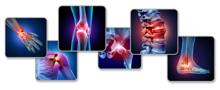 Osteopatia w chorobach kostno-stawowych